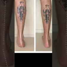 Knee Pain: Can You see it?