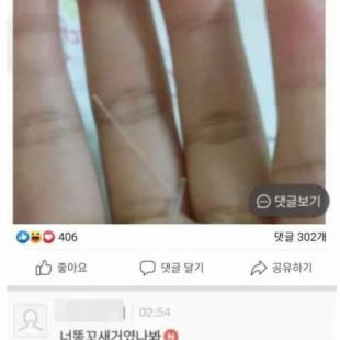 간지러워서 똥꾸녕을 긁었는데.jpg