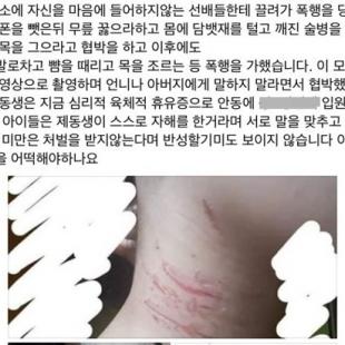 안동서 여중생 집단 폭행 주장 SNS 올라…경찰 수사