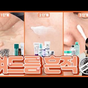 [*Eng] 여드름 흔적 관리, 이렇게 하니 정말 쉽네! ✅️ 톱오브톱 추천템들로 정리해 봤습니다 by 디렉터파이